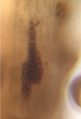 cessation structures commonly found in crown tissues