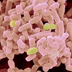 Bacteria